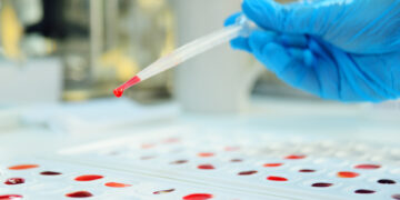 Misterio resuelto tras 50 años de investigación: detectado un nuevo tipo de sangre.