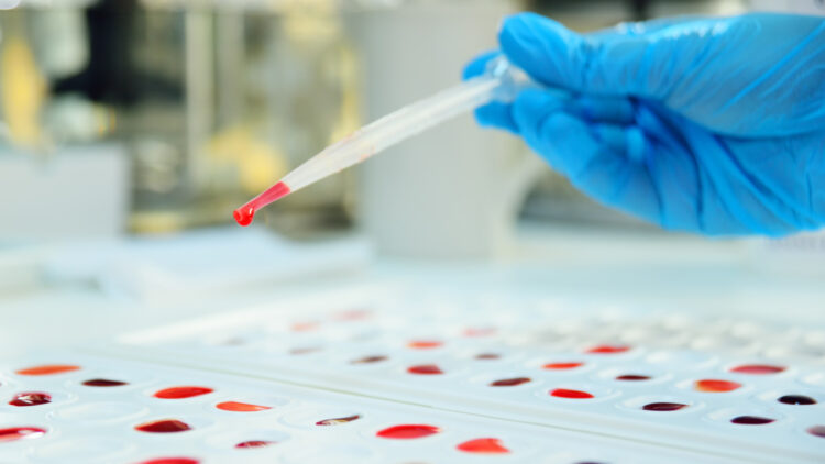 Detectado un nuevo tipo de sangre tras 50 años de investigación 1 Misterio resuelto tras 50 años de investigación: detectado un nuevo tipo de sangre.