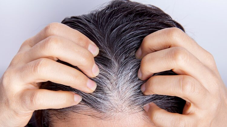 Adiós a las canas: retrásalas tomando a diario estas vitaminas 1 Adiós a las canas: retrásalas tomando a diario estas vitaminas.