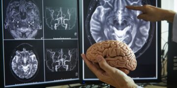 ‘Cerebros extraordinarios', la iniciativa que busca revolucionar la investigación del Alzheimer, el Parkinson o la ELA.