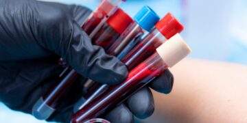 New blood type found - mystery solved