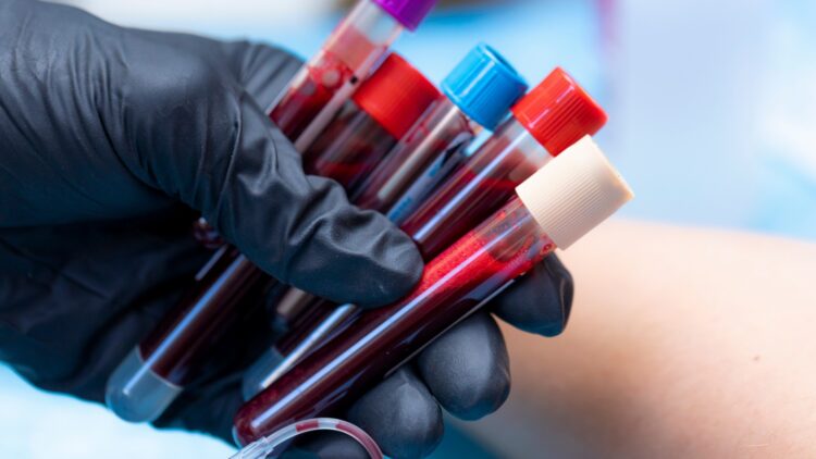 New blood type found - mystery solved