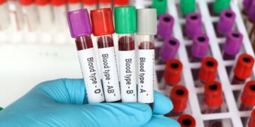 Good news for people with this blood type - they age much slower, according to a scientific study