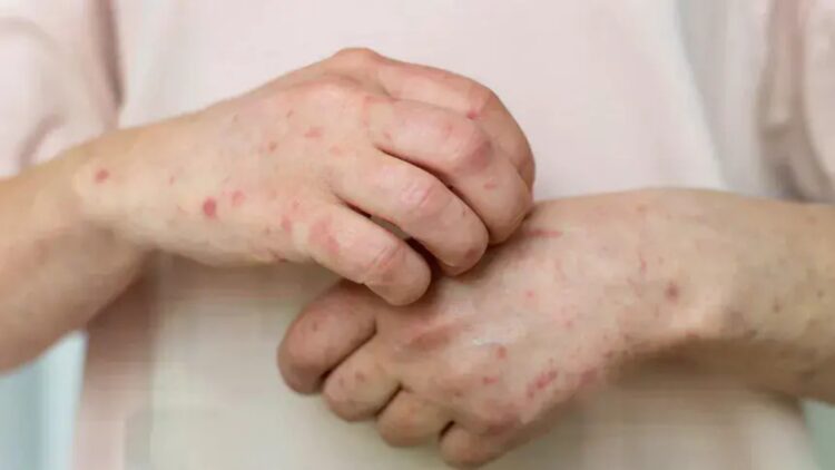 Shaun Yang, Director of the Department of Pathology at UCLA—no one will be able to live normally with this new disease that is spreading throughout the US