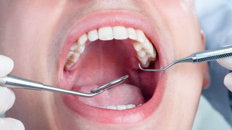 No pain, no swelling - that's how an overlooked cavity nearly cost this unfortunate man his life