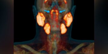 Confirmed - doctors reveal the existence of an unknown organ in the throat after decades of anatomical studies