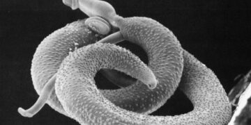 Goodbye to pain—Scientists discover how a worm invades your body without you feeling it and turns off your pain and heat alarms