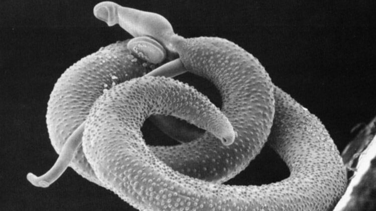 Goodbye to pain—Scientists discover how a worm invades your body without you feeling it and turns off your pain and heat alarms