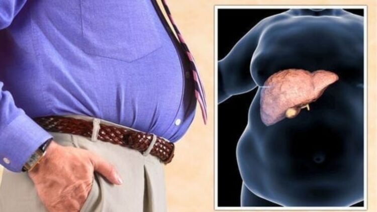 Dr. Saurabh Sethi, gastroenterologist and Harvard and Stanford graduate - "these are the 5 signs you can check yourself for fatty liver"