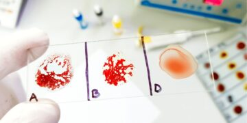 Confirmed by the University of Cambridge and hematology centers—the discovery of a hybrid blood type opens up a new line of medical research