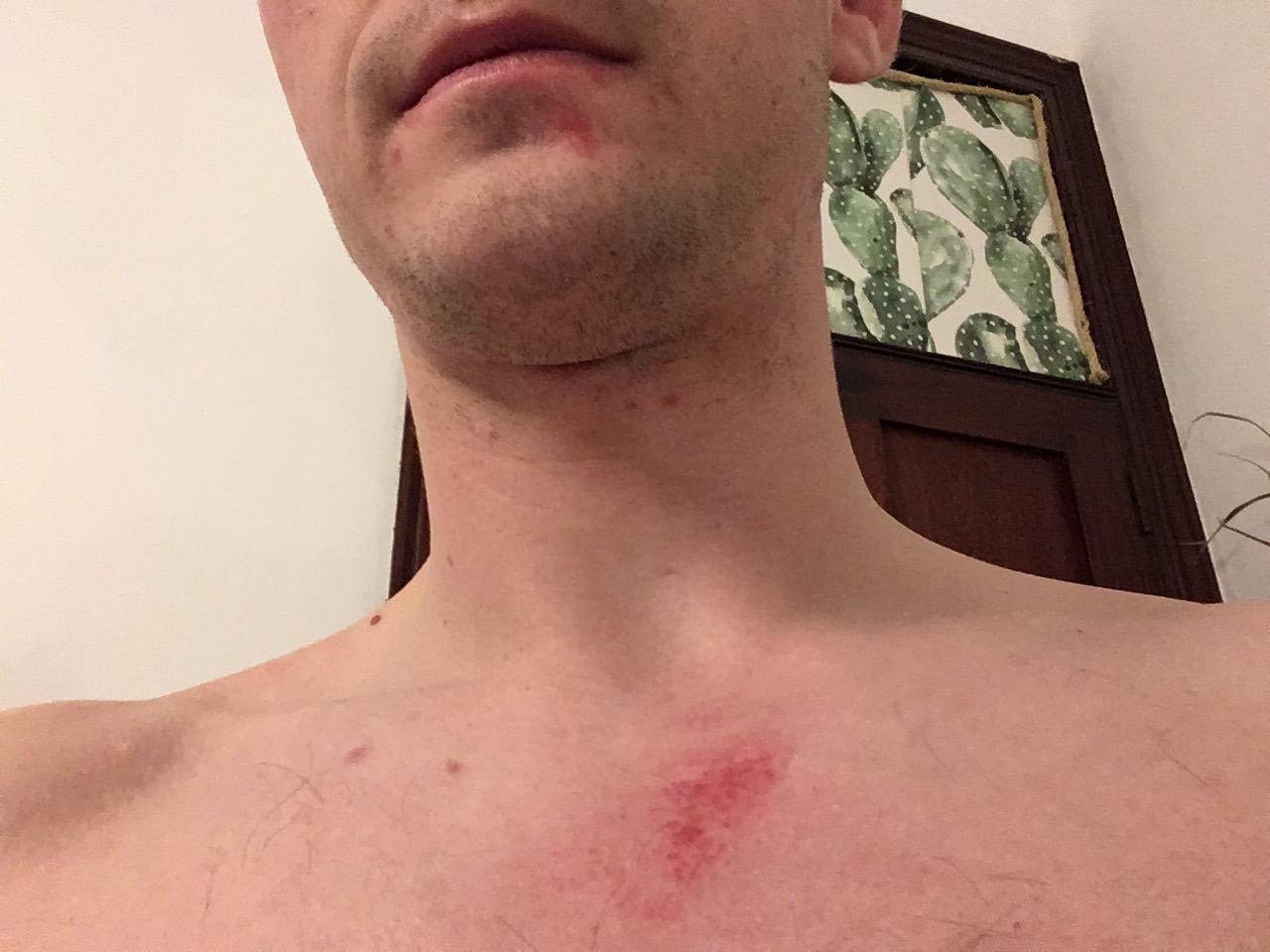 Denuncian la agresión a un aficionado del Rayo Vallecano en Las Palmas 1 img 6764